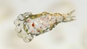 Cerebri comedentis vulgaris